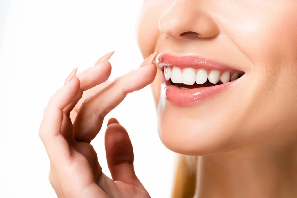 Close-up-look-at-her-dental-veneers-san-francisco